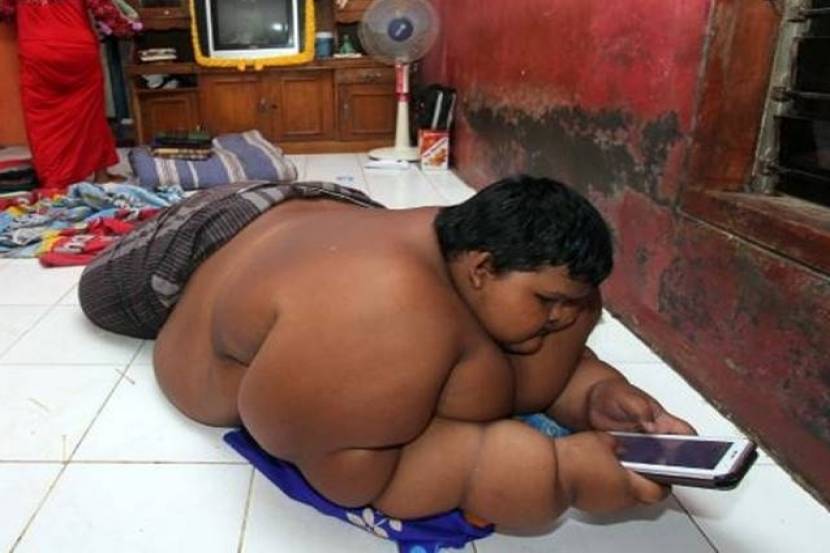worlds fattest child