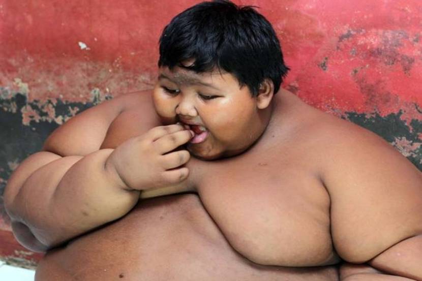 worlds fattest child