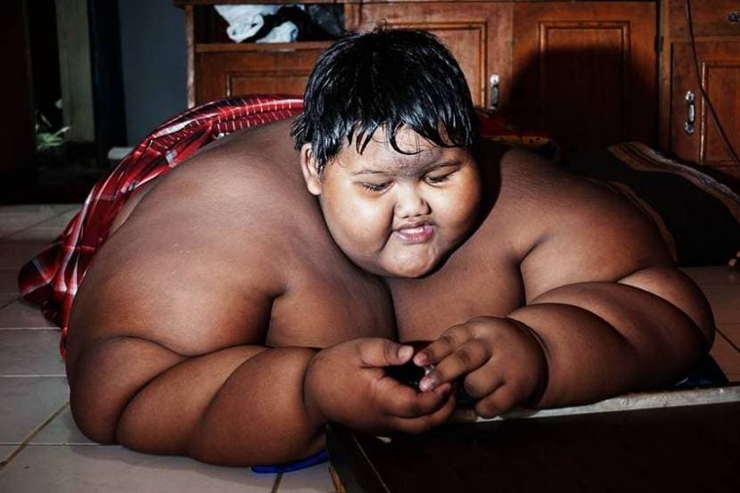 worlds fattest child