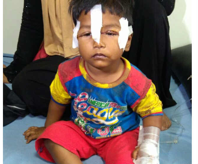 Pune , Accident happens with child due to Kite Manja , kite thread, Loksatta, loksatta news, Marathi, Marathi news