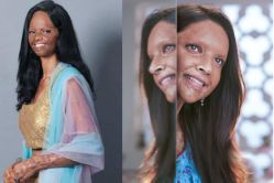 #Chhapaak : जाणून घ्या अॅसिड हल्ल्यातून बचावलेल्या लक्ष्मीची हृदयद्रावक कथा