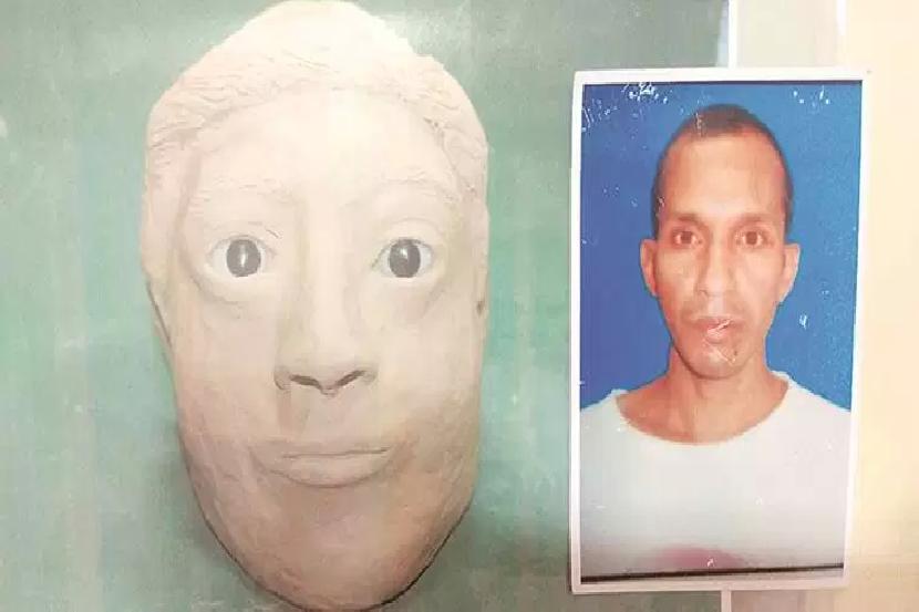 Vijay Yadav, his facial reconstruction