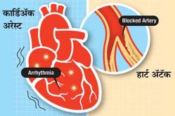 जाणून घ्या हार्ट अ‍ॅटॅक आणि कार्डिअ‍ॅक अरेस्ट यातला फरक