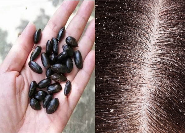 ८. सीताफळांच्या बियांची पूड रात्री झोपताना केसांना चोळून लावल्याने उवा मरतात व डोक्यातील कोंडाही जातो. बियांच्या या पूडमध्ये शिकेकाई घालून केस धुतल्यास केस स्वच्छ व चमकदार होतात व उवा व लिखाही होत नाहीत