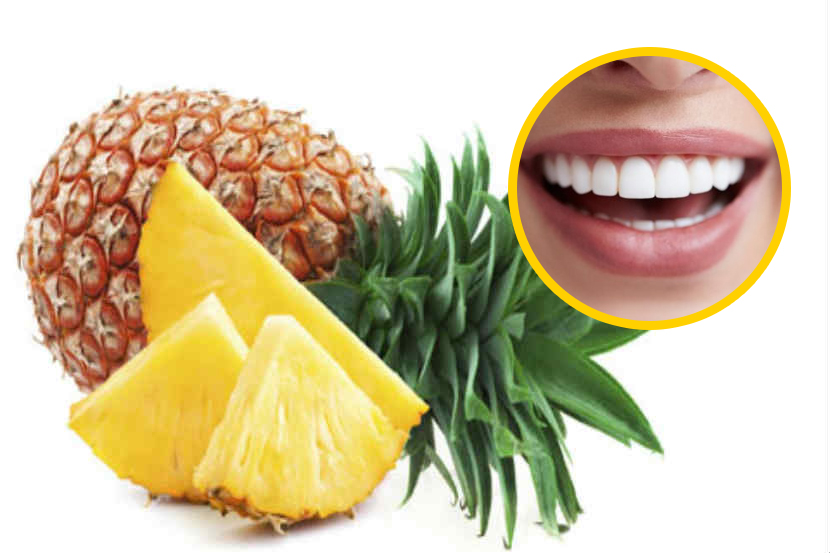 अननस खाणे - अननसामध्ये असलेला ब्रोमेलेन हा घटक दातांचा पिवळेपणा कमी करण्यास मदत करतो.