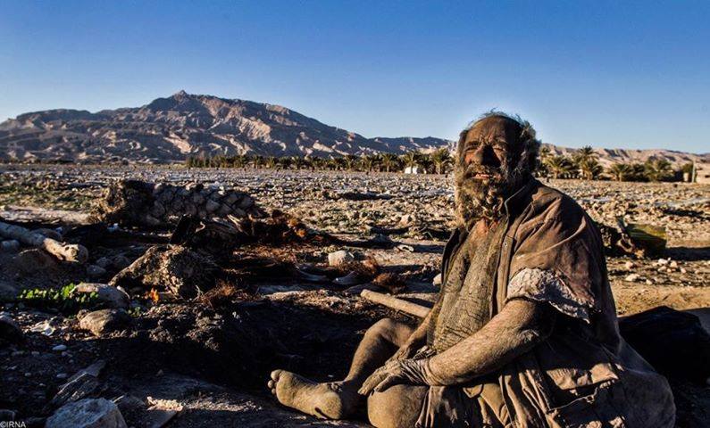 अमो यांना पाण्याची प्रचंड भीती वाटते. म्हणूनच ते मागील ६७ वर्षांपासून एकदाही अंघोळ केलेली नाही. आपण अंघोळ केली तर आजारी पडू असं अमो यांना वाटतं. शरीर स्वच्छ ठेवल्यास त्या स्वच्छतेमुळेच आपण आजारी पडू असा अमो यांचा समज आहे.