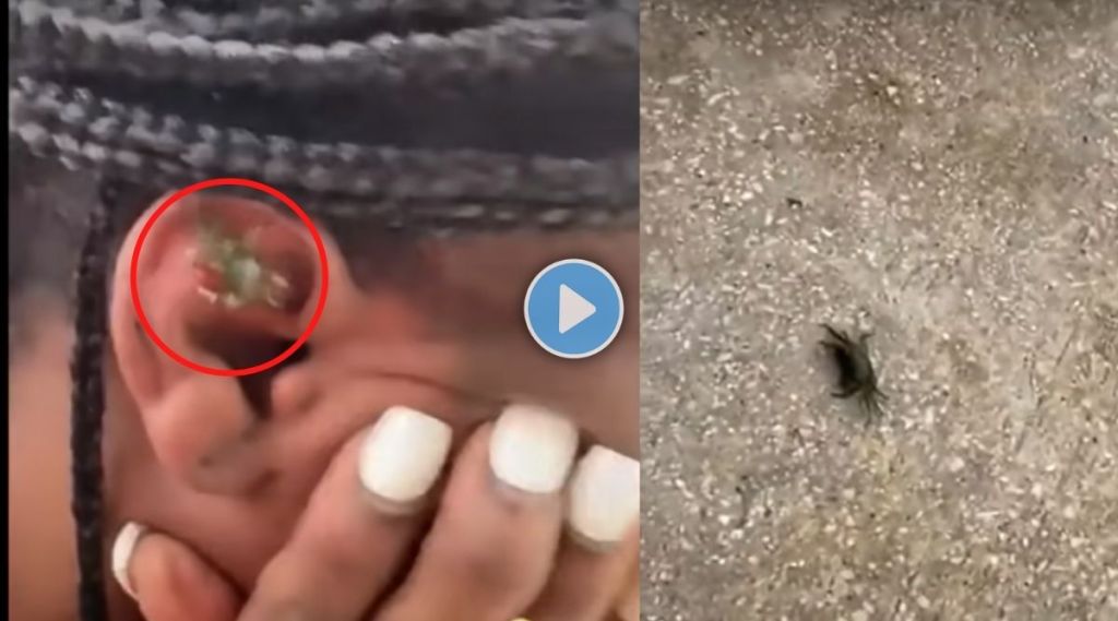 crab stuck inside a woman ear