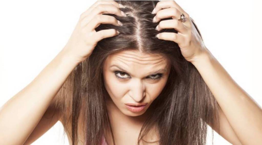 Dandruff causing hair loss?