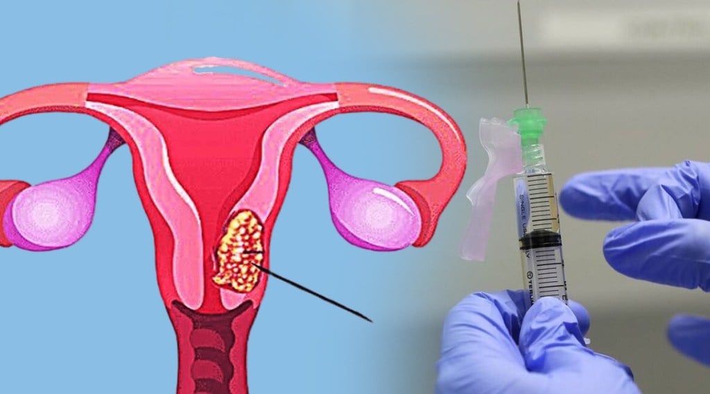 cervical cancer vaccine