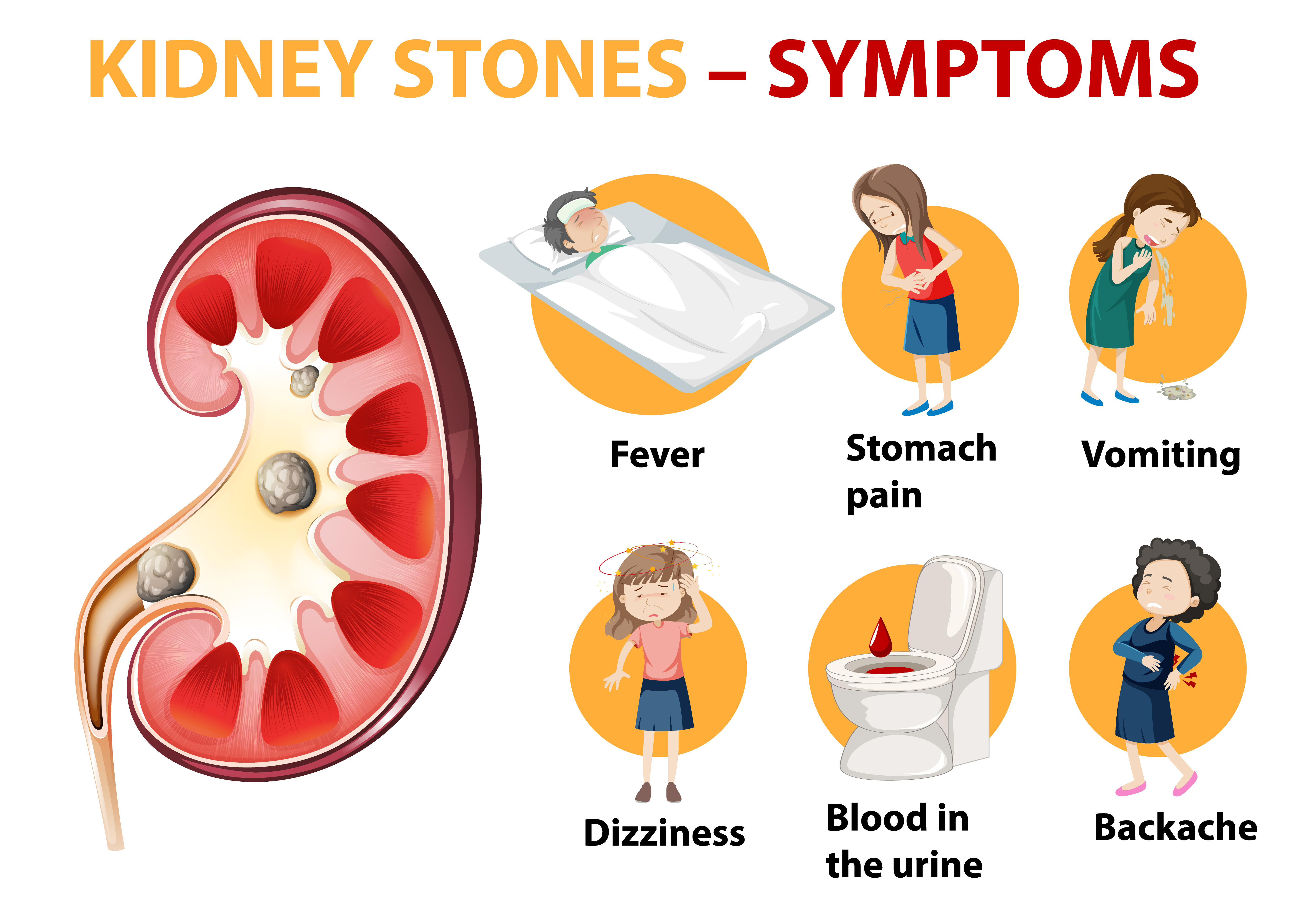 kidney stone diet