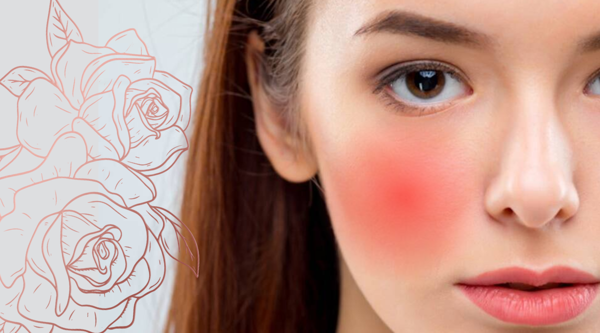 red-pink-cheeks-can-be-symptom-of-rosacea-disease-why-cheeks-turn-red