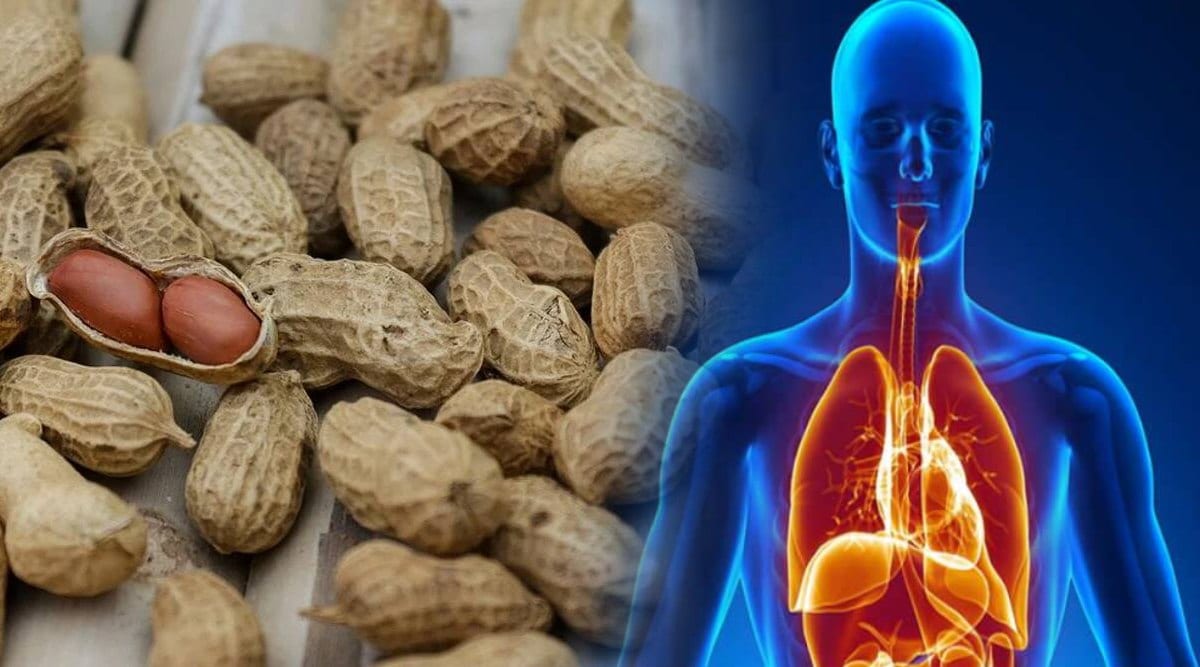 dont-consume-peanuts-in-high-blood-pressure-liver-problem-and-joint