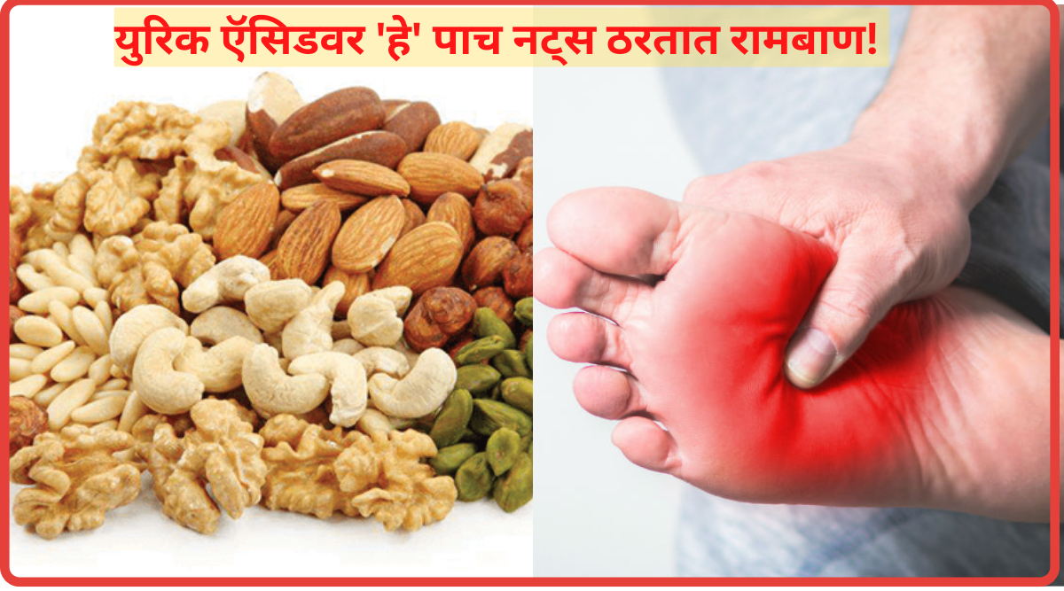 Dry Fruits That Reduce Uric Acid How Much Cashew Almonds Should be