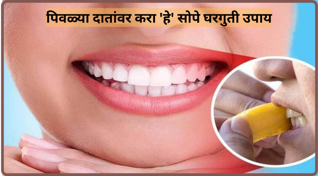 How To Get Whiter Teeth at Home Easy Tips To Get Rid Of Yellow Teeth