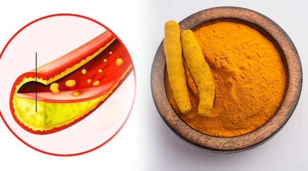 Turmeric can be beneficial in cholesterol problem know how to consume