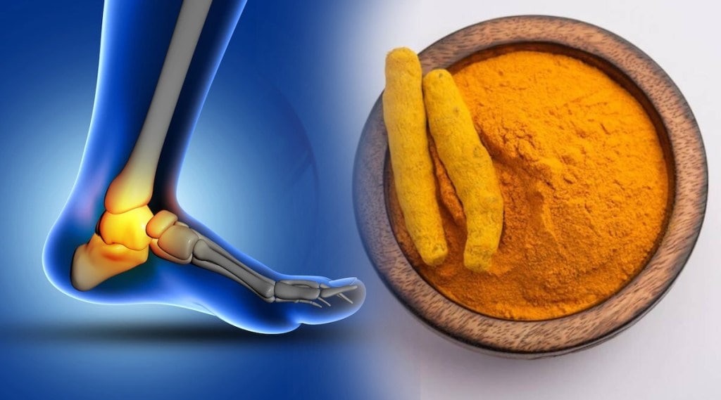 haldi for uric acid