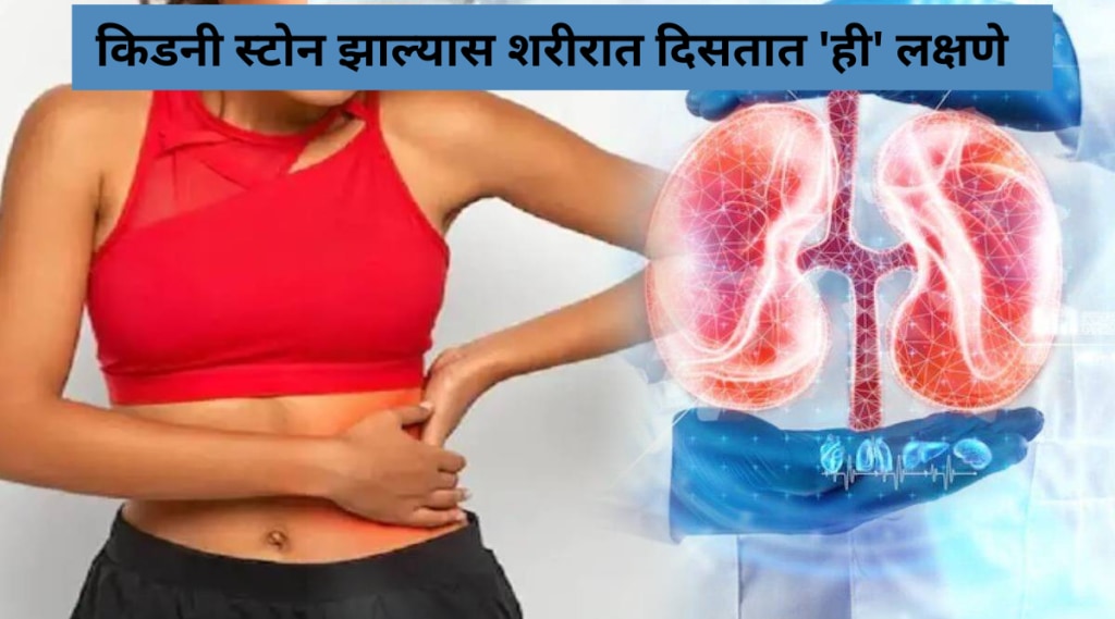 kidney-stone-early-signs-by-body-what-food-trigger-kidney-failure-know