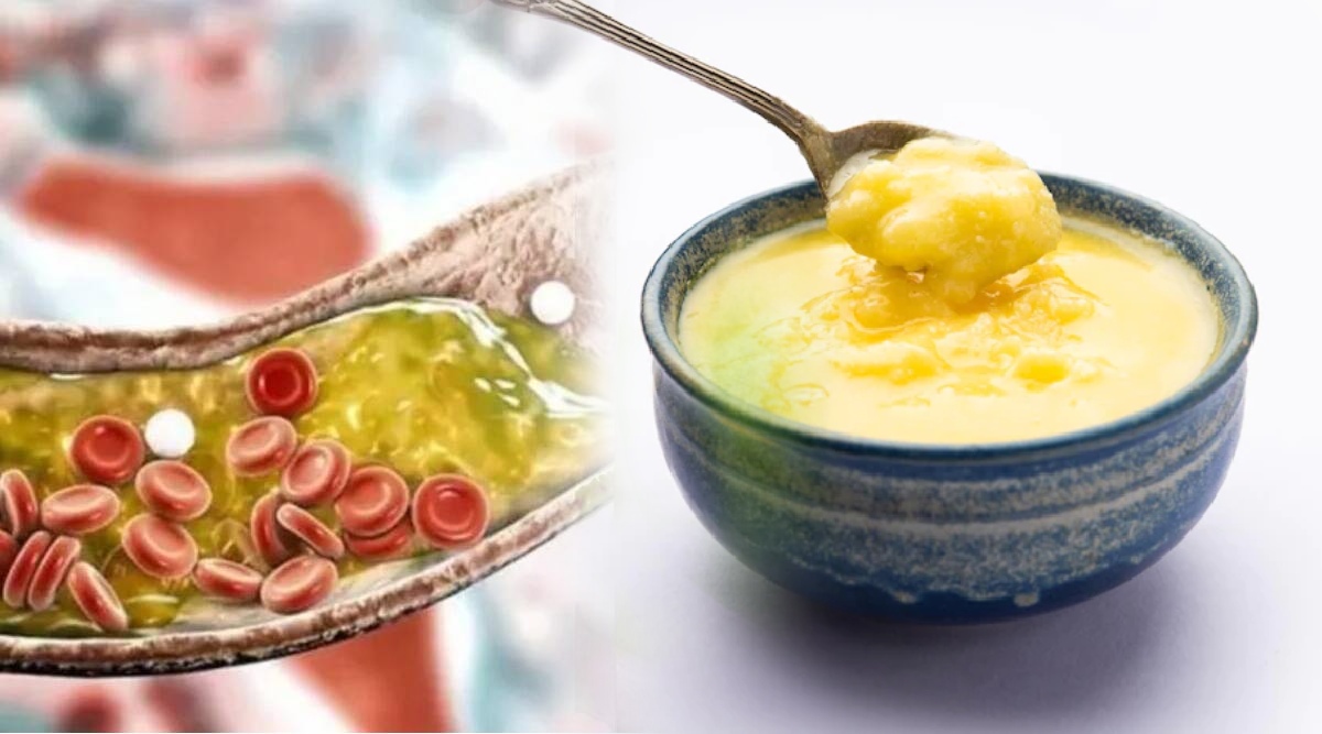 Cholesterol Can Increase By Consumption Of Ghee Know How Much To Consume It