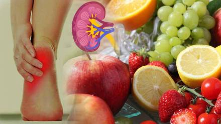 Kidney Failure Due To This Fruits That Boost Uric Acid Know Symptoms and Low Sugar Vegetables By Health expert