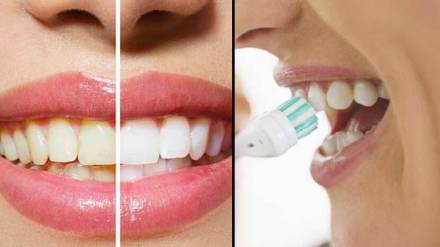 home remedies for yellow teeth