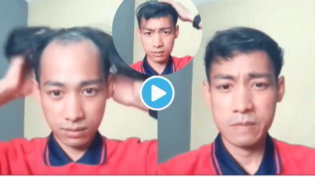 Video Man Jugaad To Cover Bald Spots On Head Without Wig or Hair Transplant These Hack Will Save Your Money