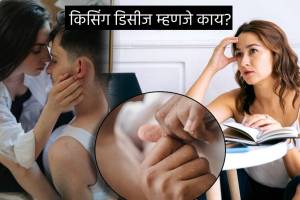 Kissing Disease Spreading Virus Extreme Tiredness and Throat Pain Check These 8 Signs of Body Health Expert Advice