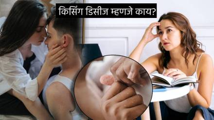 Kissing Disease Spreading Virus Extreme Tiredness and Throat Pain Check These 8 Signs of Body Health Expert Advice