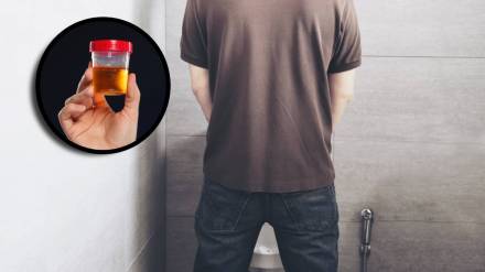 smelly urine causes and symptoms