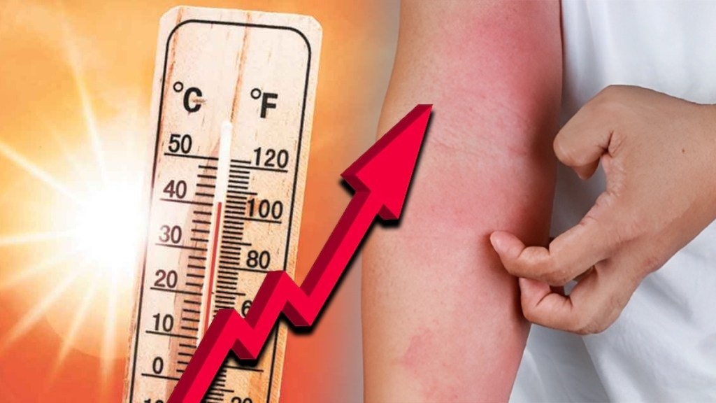 increasing heat citizens suffer skin diseases patients 30 percent mumbai