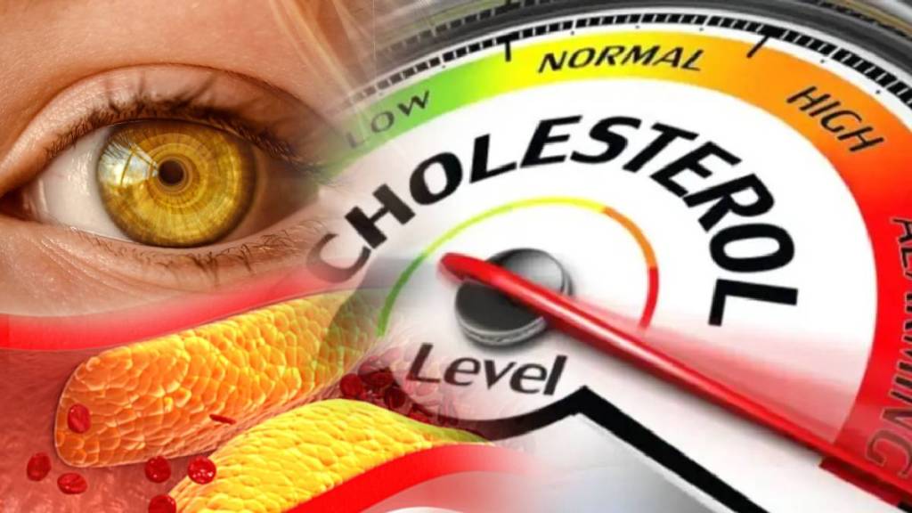 If Bad Cholesterol Goes Out Of Control These signs can be seen in your eyes why eyelids pain yellow spots how to pass through urine