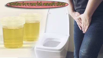 Why Pee Is Dark Yellow Orange Red and Smells Bad Spot These Signs Of Body About Major Issues How To Check pee Color