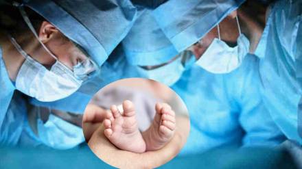 US doctors perform brain surgery on baby still in womb