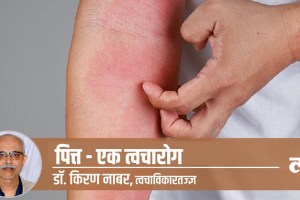 hives pitta skin problem