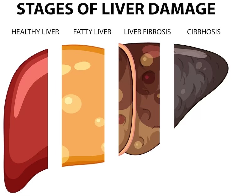 liver-health-tips