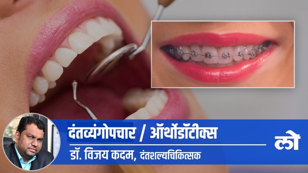 orthodontist dental treatment