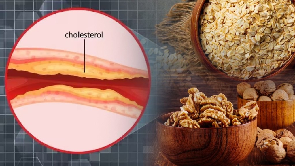 Home Remedies to Reduce Cholesterol Control