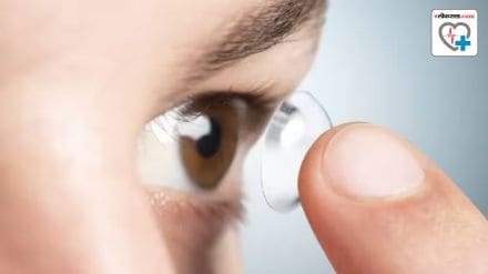 Contact lenses how to use