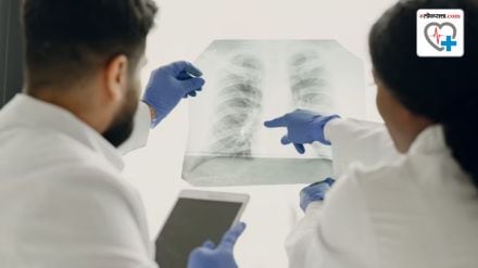 lung cancer detection