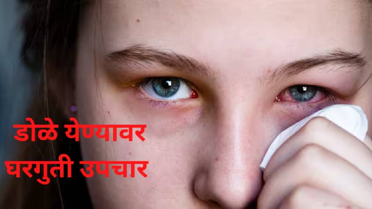 Dole Yene Eye Flu Signs And Home Remedies How To Keep Eyes Clean And Safe During Conjunctivitis Spread In Maharashtra 