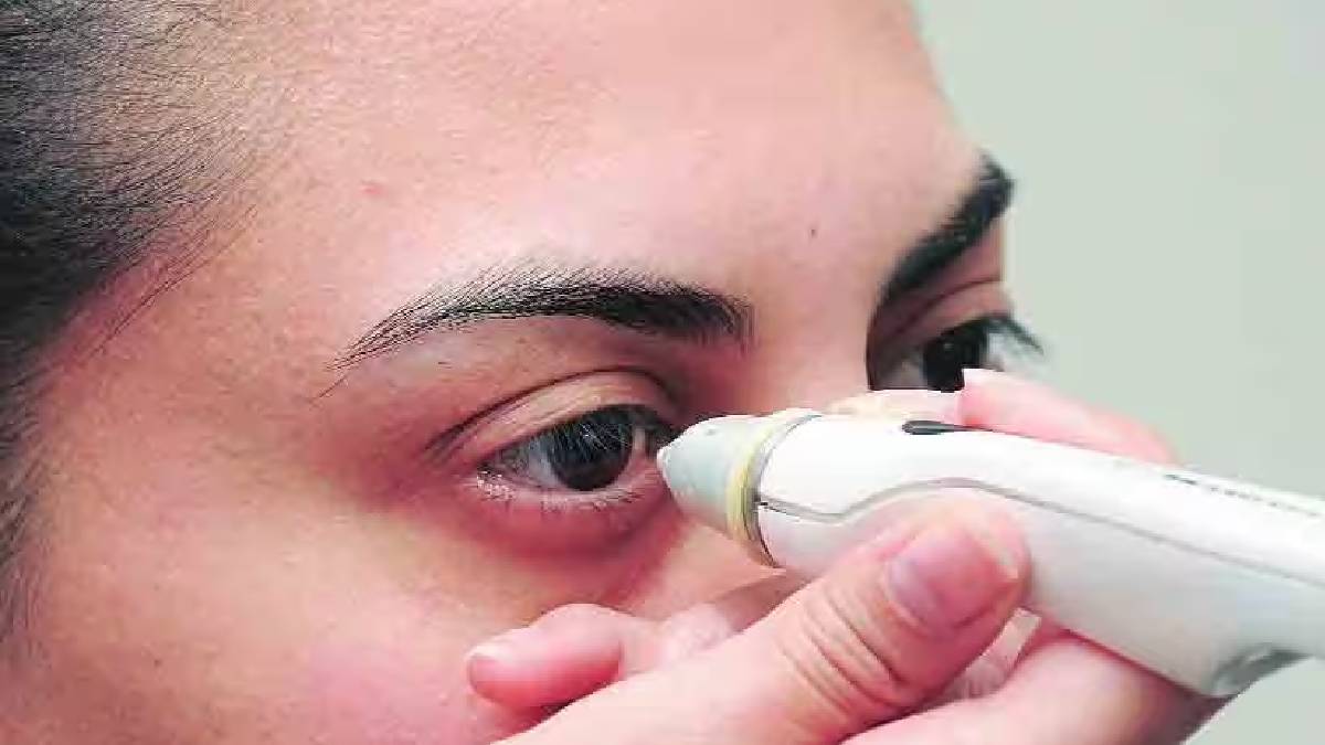 Dole Yene Eye Flu Signs And Home Remedies How To Keep Eyes Clean And Safe During Conjunctivitis Spread In Maharashtra 