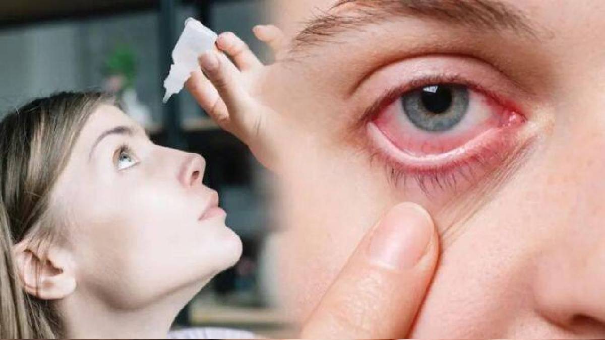 Dole Yene Eye Flu Signs And Home Remedies How To Keep Eyes Clean And Safe During Conjunctivitis Spread In Maharashtra 