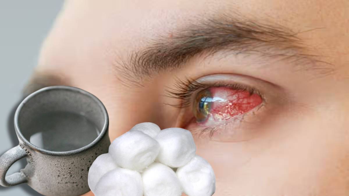 Dole Yene Eye Flu Signs And Home Remedies How To Keep Eyes Clean And Safe During Conjunctivitis Spread In Maharashtra 