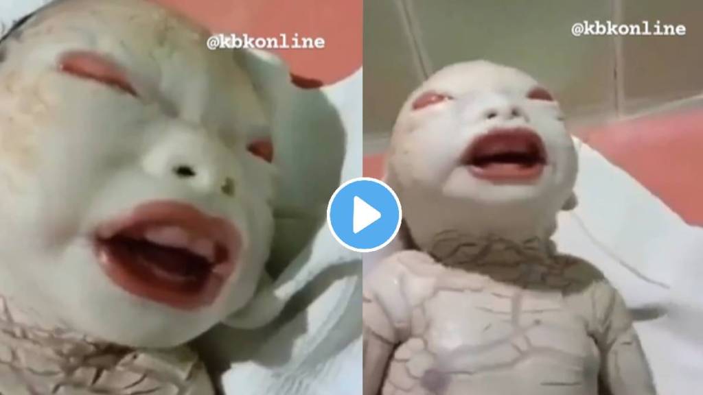 child born with rare genetic disorder harlequin ichthyosis baby called alien shaitaan ka bchcha genetic disorder video viral on internet today trends