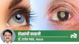 cataract, eye treatment