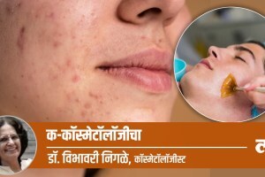 pimples treatment