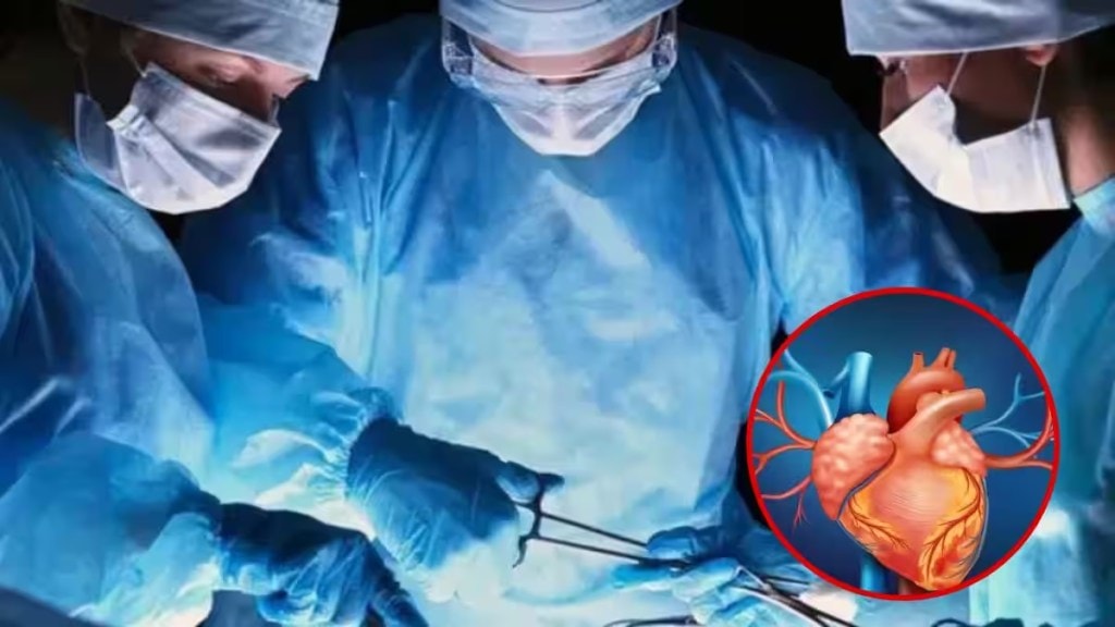 heart Surgery