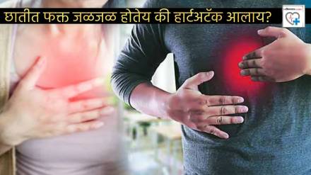 Burning In Chest Due To Acidity or is It Heart Attack How to Spot Difference Can Pain In Left Hand Indicate Heart Disease Doctor