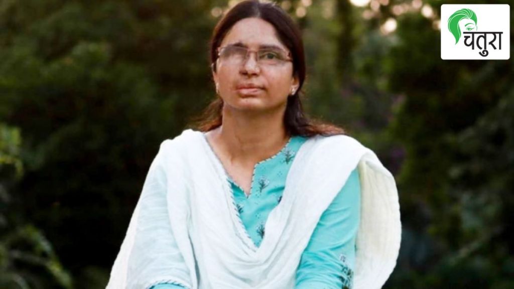 acid attack survivor shaheen malik