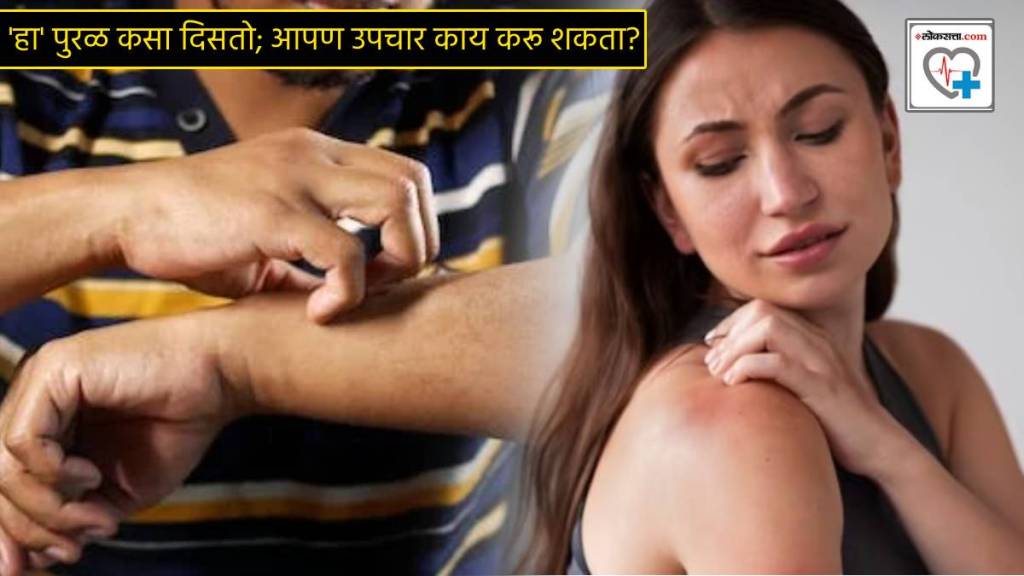 Major Itching On Skin Acid Reflux Pitta Dosha On skin Can Be Caused Due To Stress How Stress Rash Looks Remedies For Dry Skin