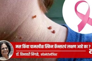 mole or wart symptom of skin cancer in marathi, treatment on mole or wart in marathi